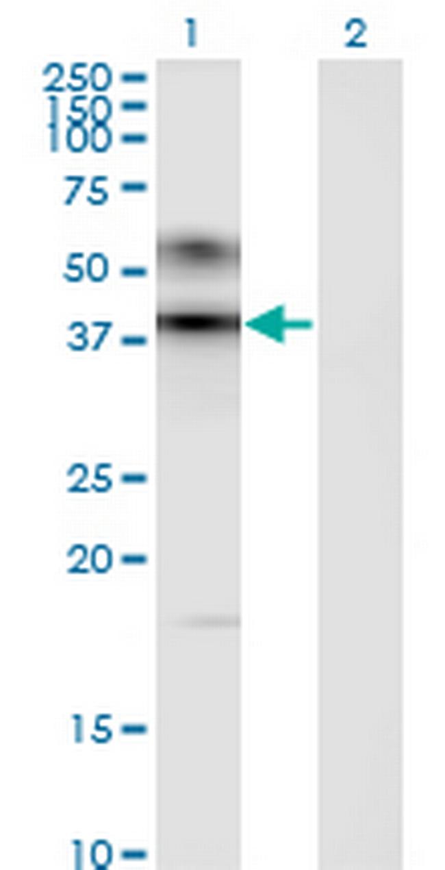 ART3 Antibody in Western Blot (WB)