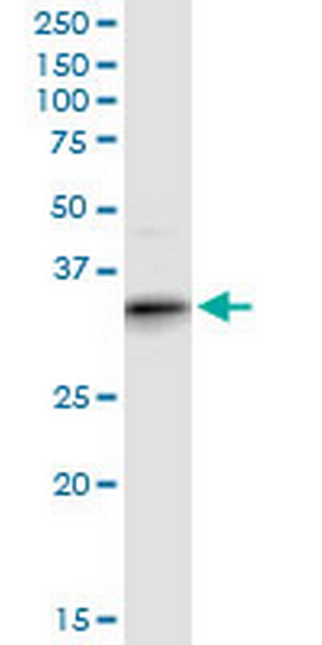 ART4 Antibody in Western Blot (WB)