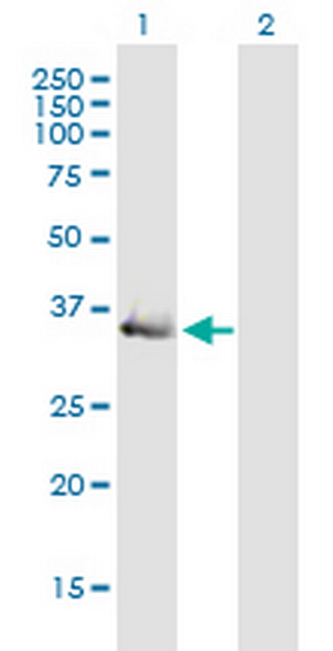 ART4 Antibody in Western Blot (WB)
