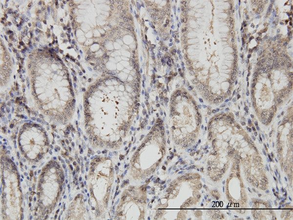 ARVCF Antibody in Immunohistochemistry (Paraffin) (IHC (P))