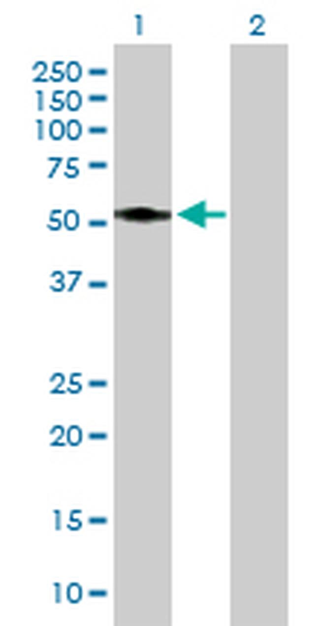ASAH1 Antibody in Western Blot (WB)