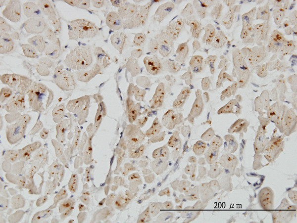 ASAH1 Antibody in Immunohistochemistry (Paraffin) (IHC (P))