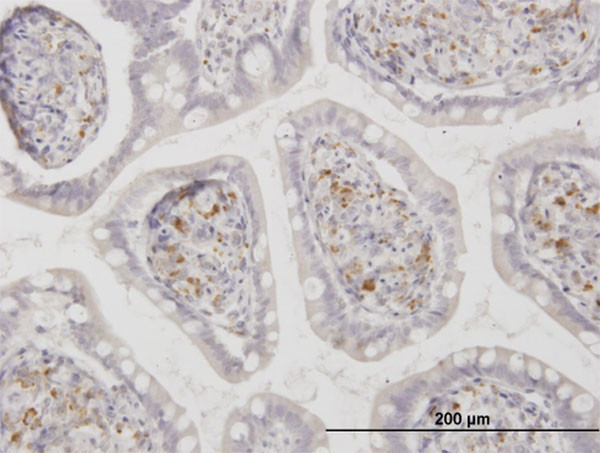 ASAH1 Antibody in Immunohistochemistry (Paraffin) (IHC (P))