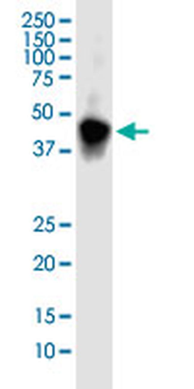 ASGR1 Antibody in Western Blot (WB)