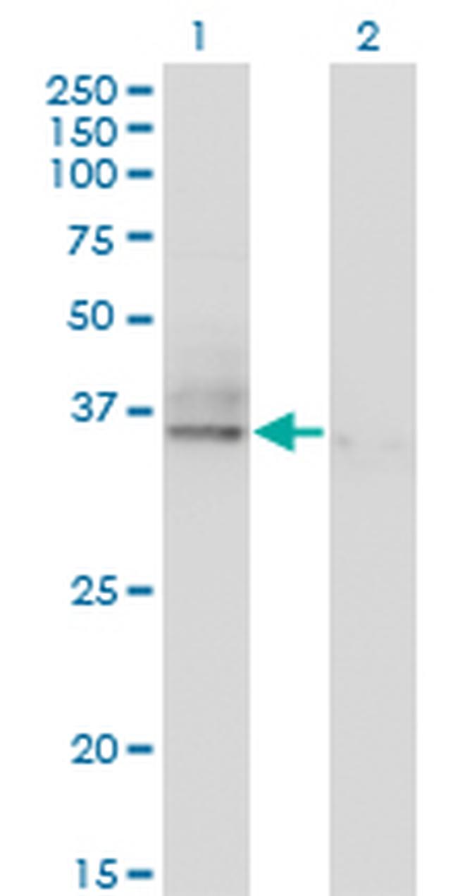 ASGR2 Antibody in Western Blot (WB)