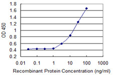 ASMT Antibody in ELISA (ELISA)