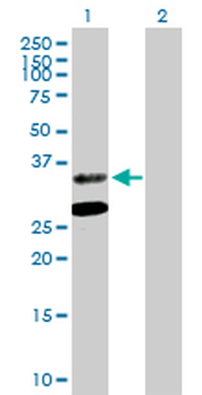 ASPA Antibody in Western Blot (WB)