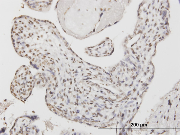 ATF1 Antibody in Immunohistochemistry (Paraffin) (IHC (P))