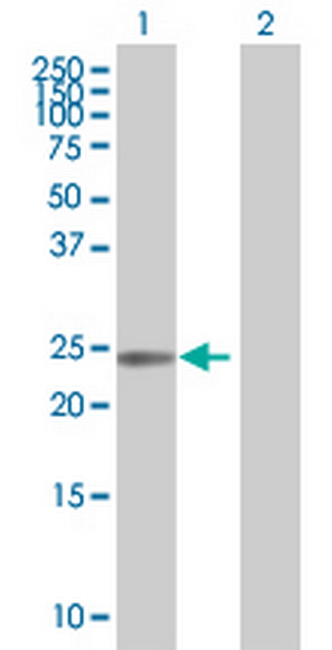 ATF3 Antibody in Western Blot (WB)