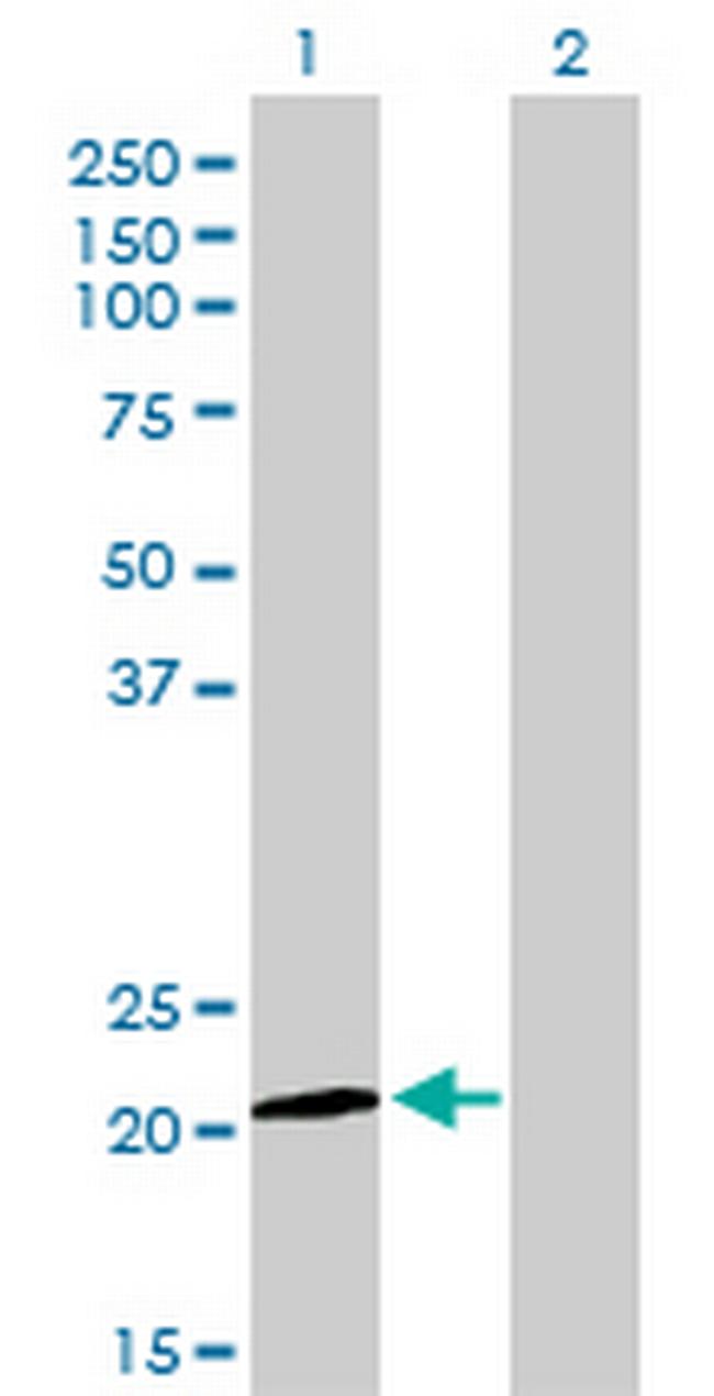 ATF3 Antibody in Western Blot (WB)