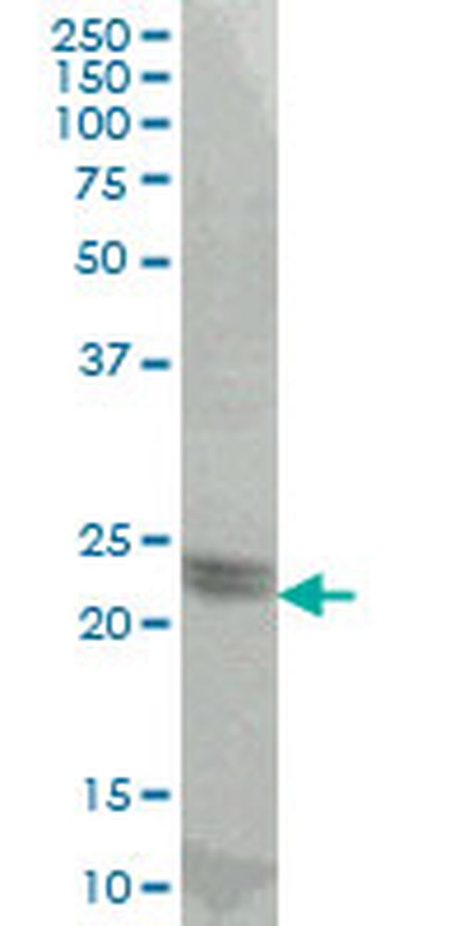ATF3 Antibody in Western Blot (WB)