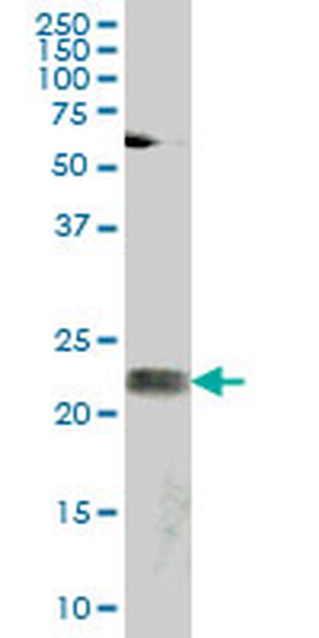 ATF3 Antibody in Western Blot (WB)