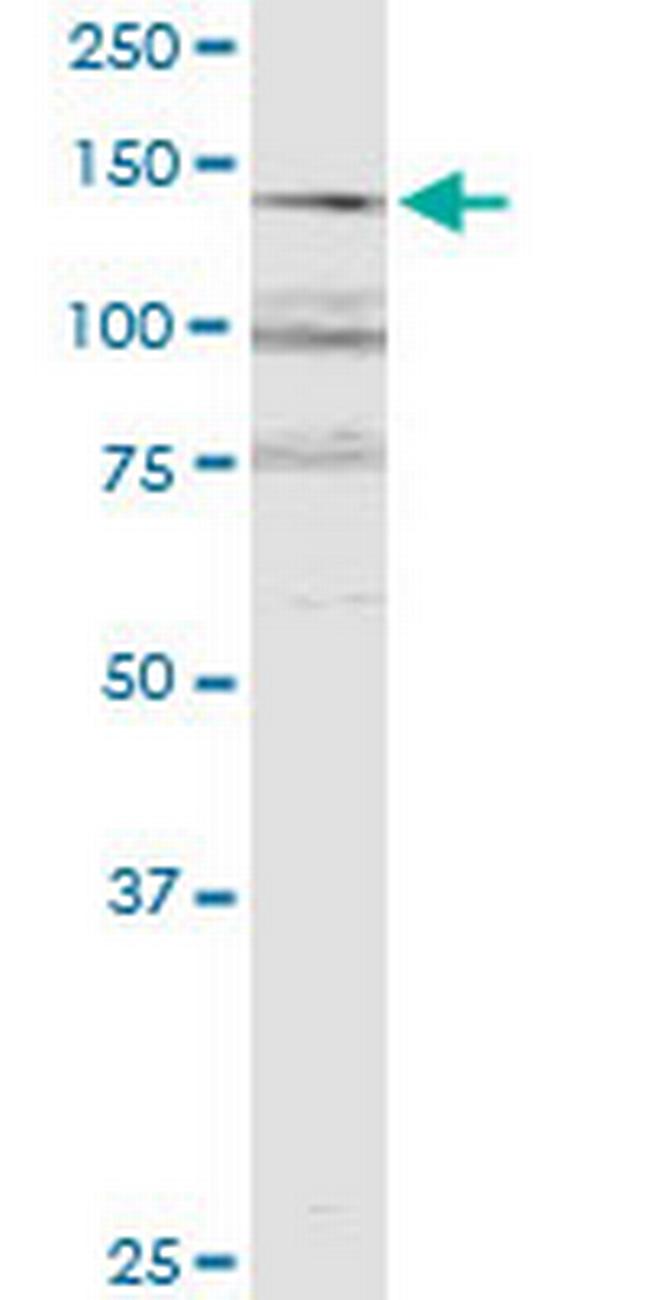 RERE Antibody in Western Blot (WB)