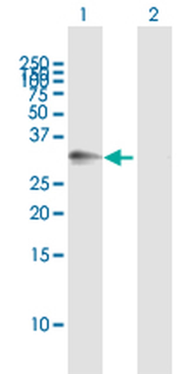 ATP1B3 Antibody in Western Blot (WB)