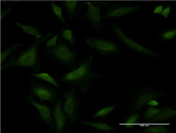 ATP2A1 Antibody in Immunocytochemistry (ICC/IF)