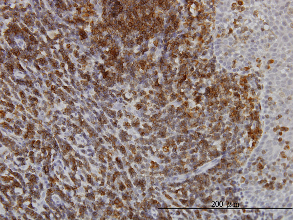 ATP2A3 Antibody in Immunohistochemistry (Paraffin) (IHC (P))