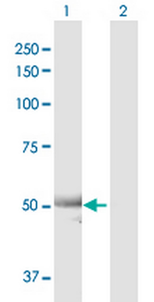 ALDH7A1 Antibody in Western Blot (WB)