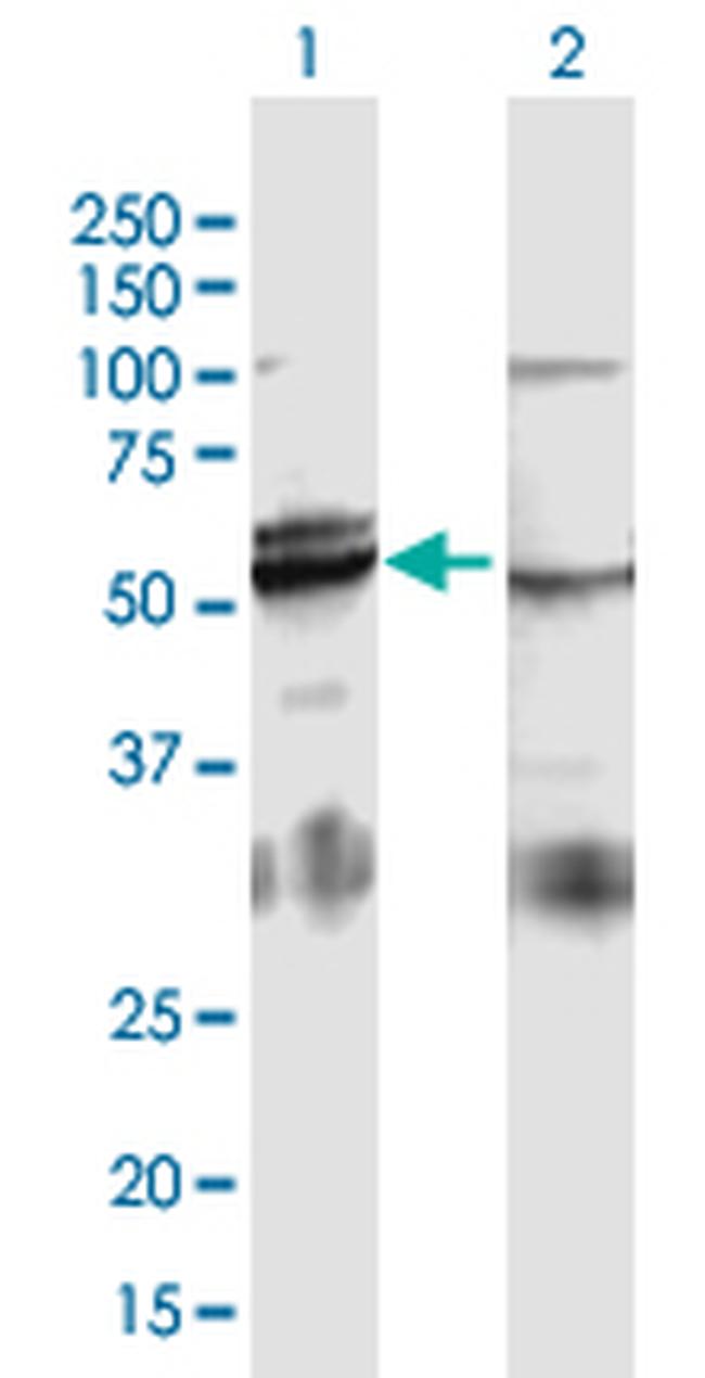 ATP5B Antibody in Western Blot (WB)