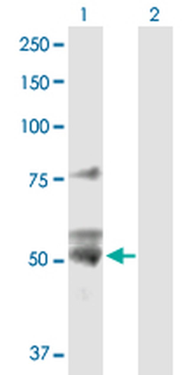 ATP5B Antibody in Western Blot (WB)