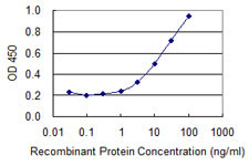 ATP6V1B1 Antibody in ELISA (ELISA)