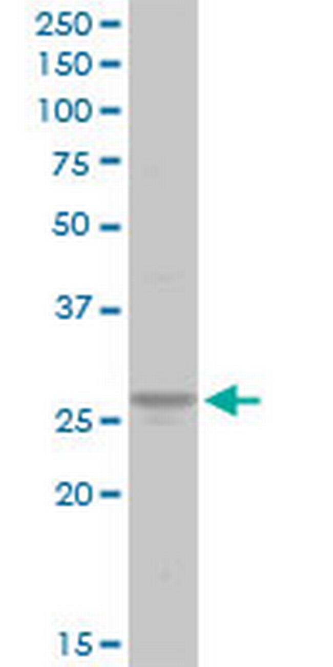 ATP6V1E1 Antibody in Western Blot (WB)