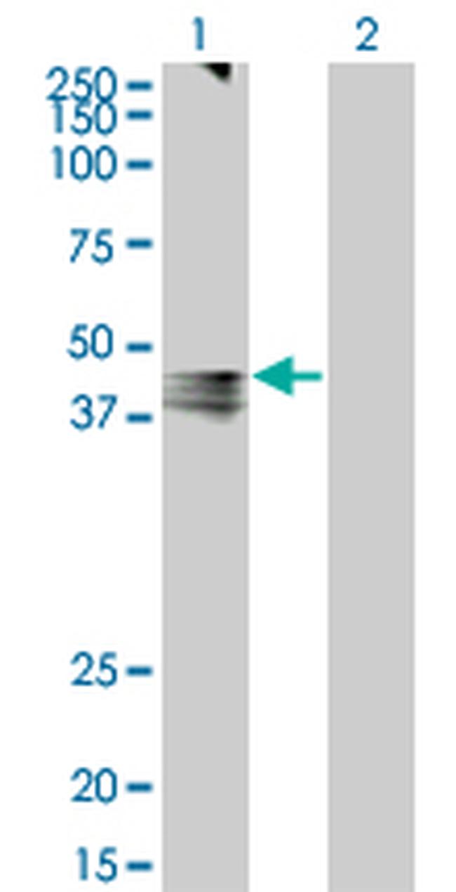 AVPR1A Antibody in Western Blot (WB)
