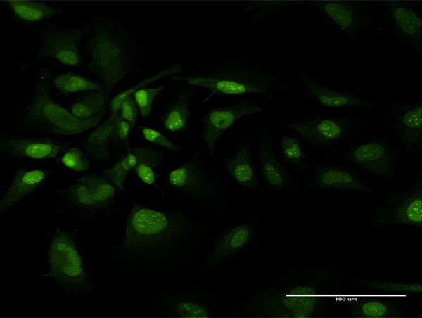 BAG1 Antibody in Immunocytochemistry (ICC/IF)