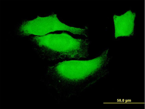 BAG1 Antibody in Immunocytochemistry (ICC/IF)