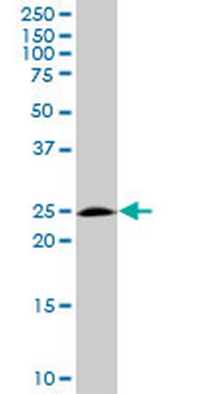 BAK1 Antibody in Western Blot (WB)