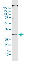 BAK1 Antibody in Immunoprecipitation (IP)