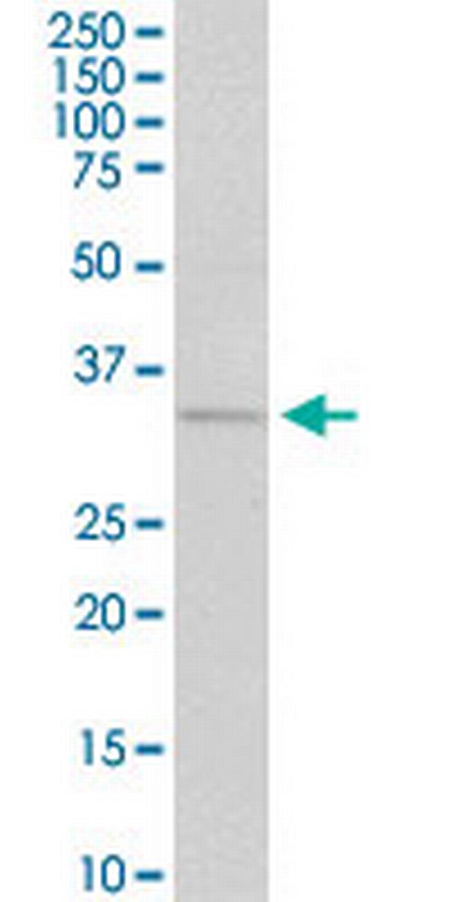CCND1 Antibody in Western Blot (WB)