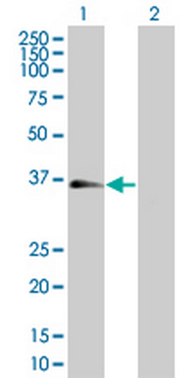 BCL2L1 Antibody in Western Blot (WB)