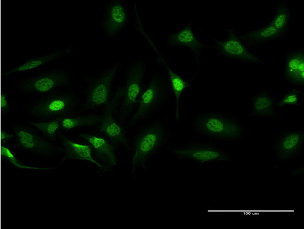 BCR Antibody in Immunocytochemistry (ICC/IF)