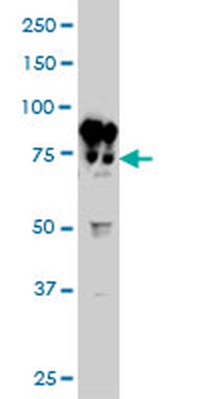 BFSP1 Antibody in Western Blot (WB)
