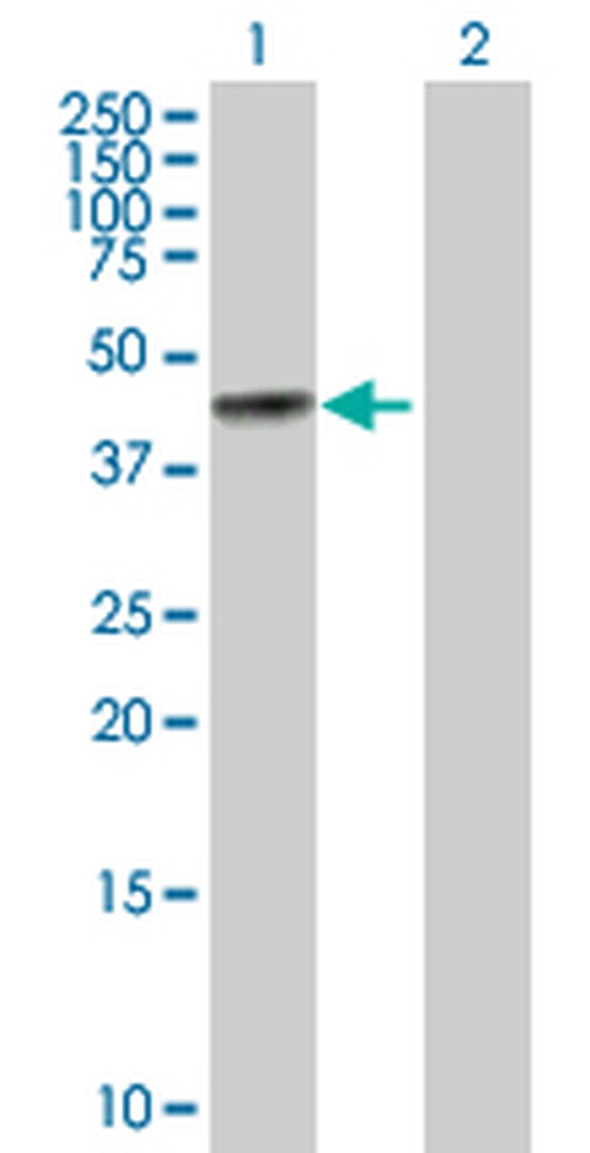 BGN Antibody in Western Blot (WB)