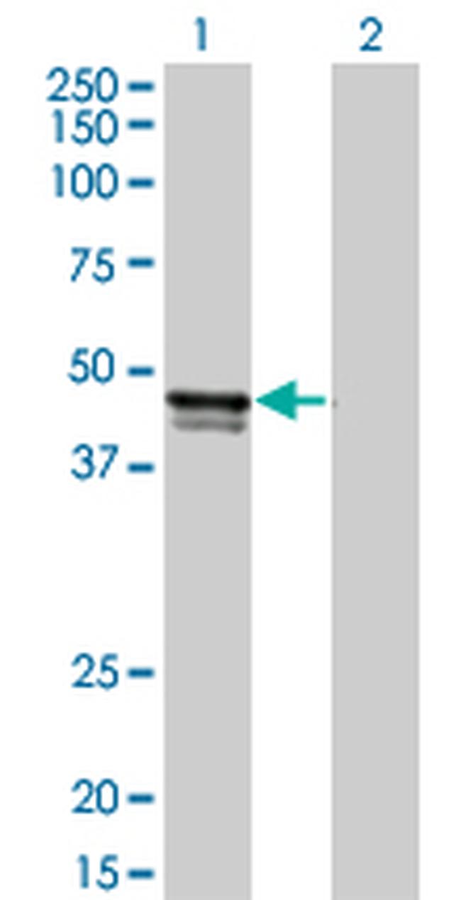 BGN Antibody in Western Blot (WB)