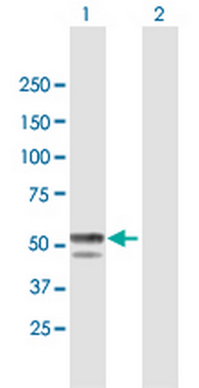 BLMH Antibody in Western Blot (WB)