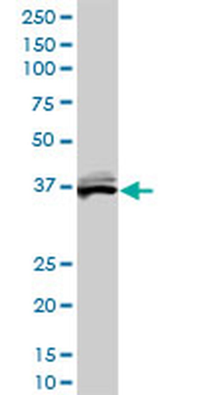 BLVRA Antibody in Western Blot (WB)