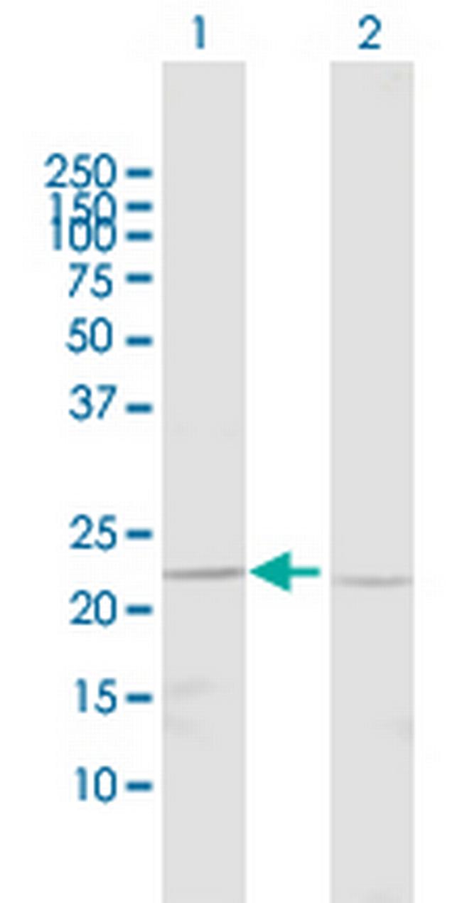 BNIP1 Antibody in Western Blot (WB)