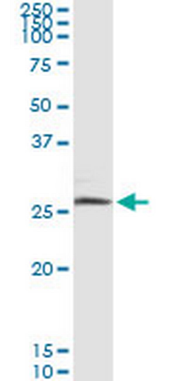 BNIP3L Antibody in Immunoprecipitation (IP)