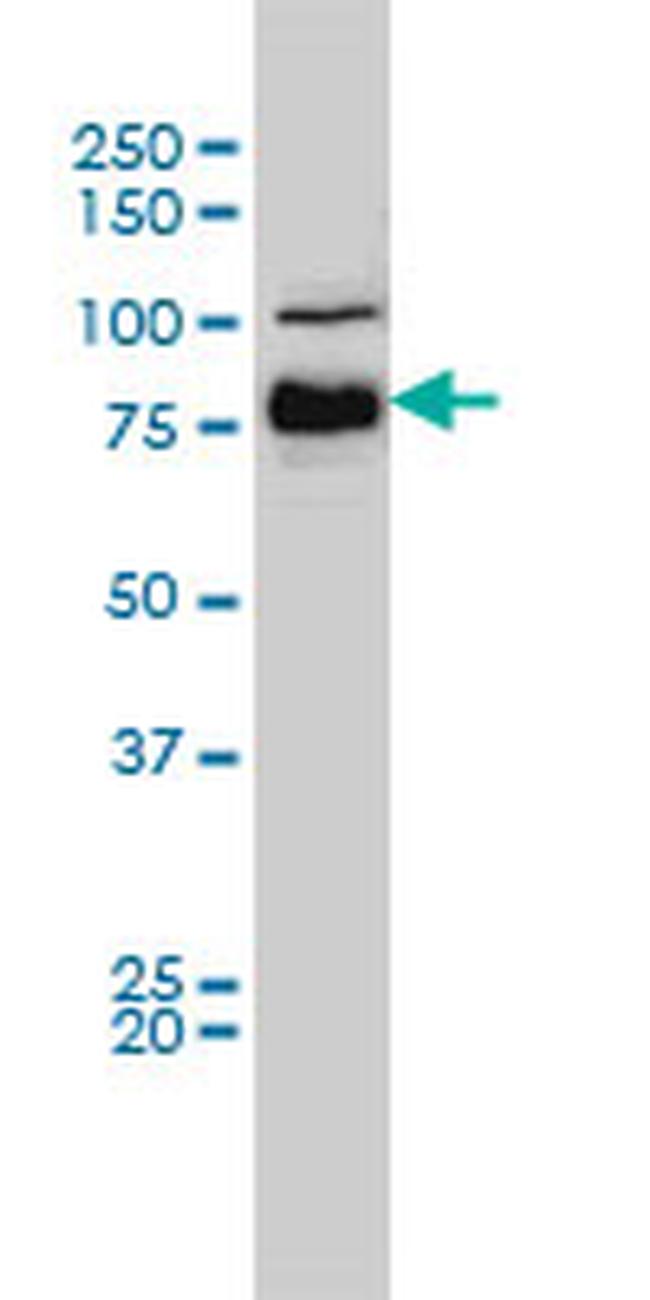 BRAF Antibody in Western Blot (WB)