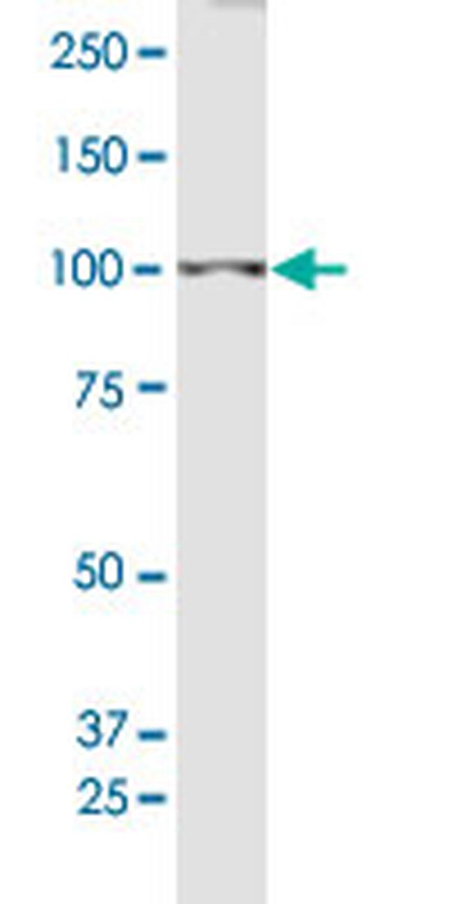 BRDT Antibody in Western Blot (WB)