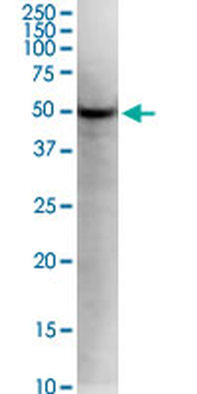 KLF5 Antibody in Western Blot (WB)