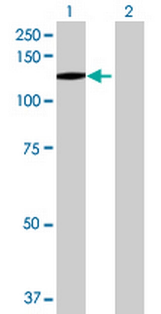 BUB1B Antibody in Western Blot (WB)