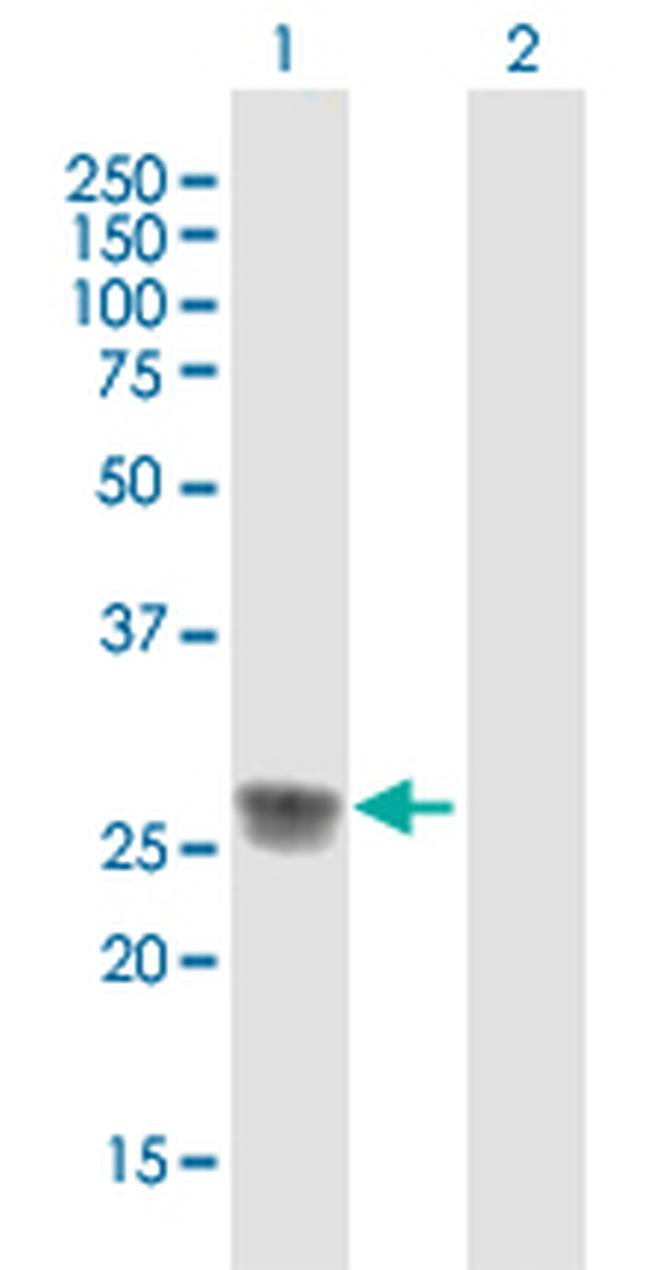 C1QA Antibody in Western Blot (WB)