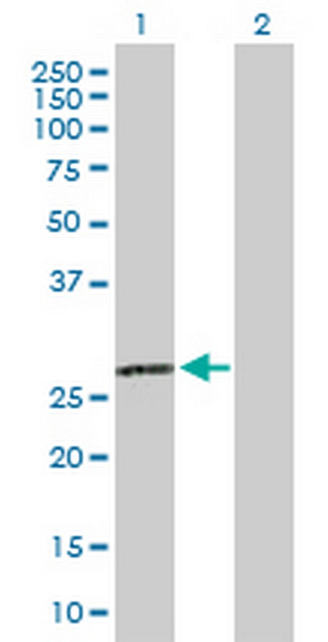 C1QA Antibody in Western Blot (WB)