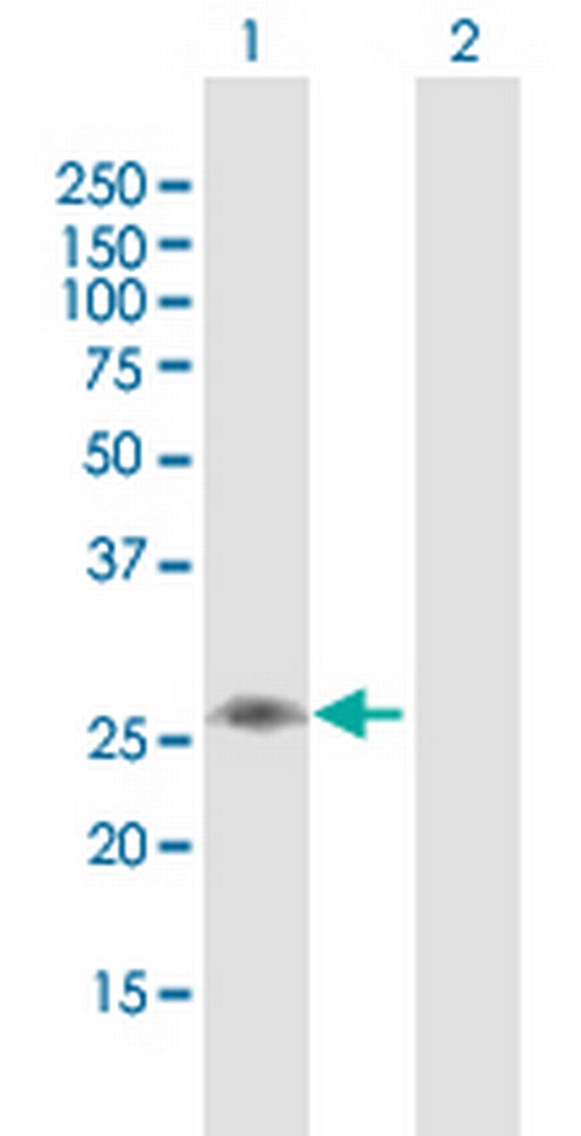 C1QB Antibody in Western Blot (WB)