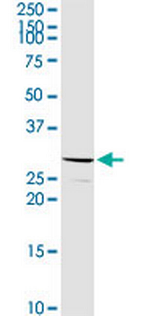 C1QB Antibody in Western Blot (WB)
