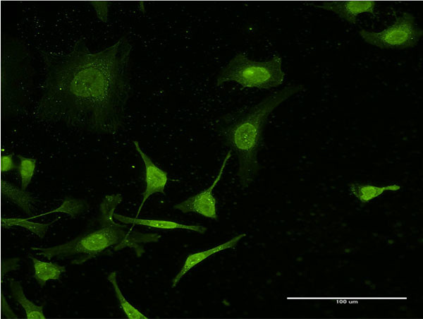 C4B Antibody in Immunocytochemistry (ICC/IF)
