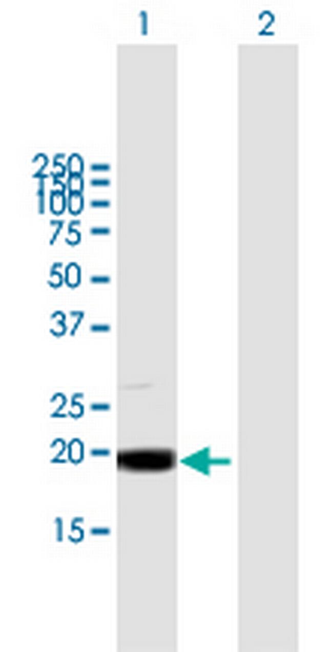 MRPL49 Antibody in Western Blot (WB)